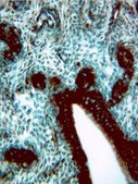 Anti-Gab1 Antibody, CT Upstate®, from rabbit