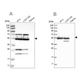 Anti-GRSF1 antibody produced in rabbit Prestige Antibodies® Powered by Atlas Antibodies, affinity isolated antibody, buffered aqueous glycerol solution