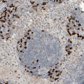 Anti-SLC12A6 antibody produced in rabbit Prestige Antibodies® Powered by Atlas Antibodies, affinity isolated antibody, buffered aqueous glycerol solution