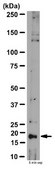 Anti-Interleukin 21 (IL-21) Antibody from rabbit, purified by affinity chromatography