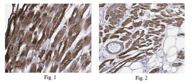 Anti-Casper/c-FLIP Antibody, clone 17B12.1 clone 17B12.1, from mouse
