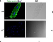 Monoclonal Anti-α-Actinin antibody produced in mouse clone BM-75.2, ascites fluid
