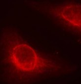 Anti-Phospho-CFL1-S3 antibody produced in rabbit