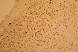 Anti-Synuclein α Antibody, clone 7B12.2 culture supernatant, clone 7B12.2, Chemicon®