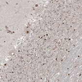 Anti-RBM10 antibody produced in rabbit Prestige Antibodies® Powered by Atlas Antibodies, affinity isolated antibody, buffered aqueous glycerol solution