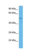 Anti-CYP2B6 antibody produced in rabbit affinity isolated antibody