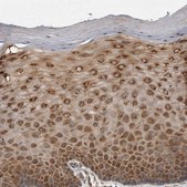 Anti-EIF3H antibody produced in rabbit Prestige Antibodies® Powered by Atlas Antibodies, affinity isolated antibody, buffered aqueous glycerol solution, Ab1