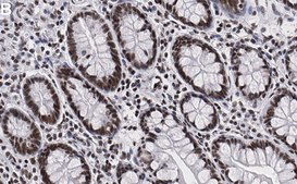 Anti-SNRNP40 Antibody, clone 1E15 ZooMAb® Rabbit Monoclonal recombinant, expressed in HEK 293 cells
