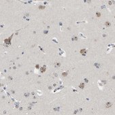 Anti-NLE1 antibody produced in rabbit Prestige Antibodies® Powered by Atlas Antibodies, affinity isolated antibody, buffered aqueous glycerol solution