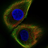 Anti-KRT17 antibody produced in rabbit Ab1, Prestige Antibodies® Powered by Atlas Antibodies, affinity isolated antibody, buffered aqueous glycerol solution