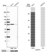 Anti-LPCAT1 antibody produced in rabbit Prestige Antibodies® Powered by Atlas Antibodies, affinity isolated antibody, buffered aqueous glycerol solution, Ab2