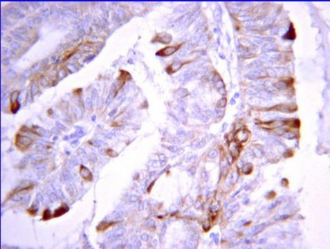 Anti-DAPK2 Antibody from rabbit, purified by affinity chromatography