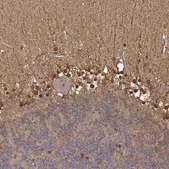 Anti-S100B antibody produced in rabbit affinity isolated antibody, buffered aqueous glycerol solution