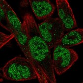 Anti-EBF1 antibody produced in rabbit Prestige Antibodies® Powered by Atlas Antibodies, affinity isolated antibody