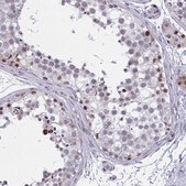 Anti-RBL1 antibody produced in rabbit Prestige Antibodies® Powered by Atlas Antibodies, affinity isolated antibody, buffered aqueous glycerol solution