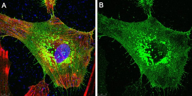 Anti-TM4SF1 Antibody
