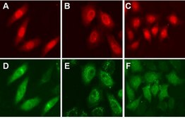 LentiBrite RFP-LC3 Control Mutant Lentiviral Biosensor