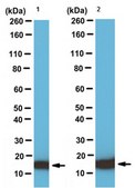 Anti-Fatty-acid binding protein 5 Antibody from rabbit