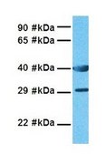 Anti-SLC10A1 affinity isolated antibody
