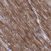 Anti-SBK2 antibody produced in rabbit Prestige Antibodies® Powered by Atlas Antibodies, affinity isolated antibody, buffered aqueous glycerol solution