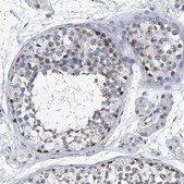 Anti-PPP2R5D antibody produced in rabbit Prestige Antibodies® Powered by Atlas Antibodies, affinity isolated antibody, buffered aqueous glycerol solution, ab2
