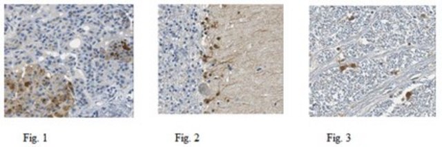 Anti-Trypsin-3 Antibody from rabbit, purified by affinity chromatography