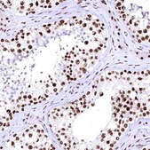 Anti-CPSF6 antibody produced in rabbit Prestige Antibodies® Powered by Atlas Antibodies, affinity isolated antibody, buffered aqueous glycerol solution