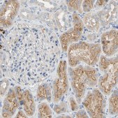 Anti-DKK3 antibody produced in rabbit Prestige Antibodies® Powered by Atlas Antibodies, affinity isolated antibody, buffered aqueous glycerol solution