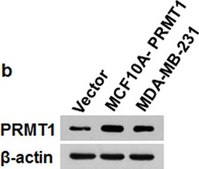 Anti-PRMT1 Antibody Upstate®, from rabbit