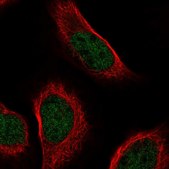 Anti-ZNF628 antibody produced in rabbit Prestige Antibodies® Powered by Atlas Antibodies, affinity isolated antibody, buffered aqueous glycerol solution