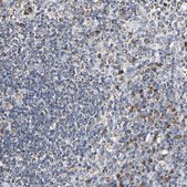 Anti-IL18R1 antibody produced in rabbit Prestige Antibodies® Powered by Atlas Antibodies, affinity isolated antibody, buffered aqueous glycerol solution