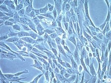 CT-2A-Luc Mouse Glioma Cell Line CT-2A-Luc mouse glioma cell line is a valuable mouse model for therapeutic research on brain malignancies.
