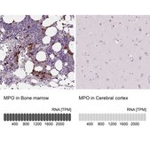 Anti-MPO antibody produced in rabbit Prestige Antibodies® Powered by Atlas Antibodies, affinity isolated antibody, buffered aqueous glycerol solution