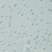Anti-NCOA2 antibody produced in rabbit