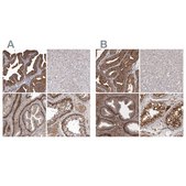 Anti-ENAH antibody produced in rabbit Prestige Antibodies® Powered by Atlas Antibodies, affinity isolated antibody, buffered aqueous glycerol solution, ab2