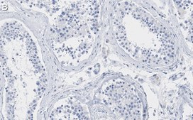 Anti-TAF6L Antibody, clone 1M8 ZooMAb® Rabbit Monoclonal recombinant, expressed in HEK 293 cells