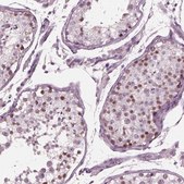 Anti-YY2 antibody produced in rabbit Prestige Antibodies® Powered by Atlas Antibodies, affinity isolated antibody