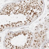 Anti-RCC1 antibody produced in rabbit Prestige Antibodies® Powered by Atlas Antibodies, affinity isolated antibody, buffered aqueous glycerol solution, ab2