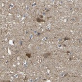 Anti-EML2 antibody produced in rabbit Prestige Antibodies® Powered by Atlas Antibodies, affinity isolated antibody, buffered aqueous glycerol solution