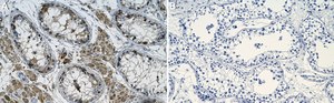Anti-IKKε Antibody, clone 1D7 ZooMAb® Rabbit Monoclonal recombinant, expressed in HEK 293 cells