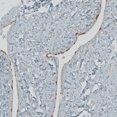 Anti-FBF1 antibody produced in rabbit affinity isolated antibody, buffered aqueous glycerol solution