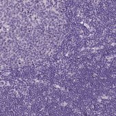 Anti-DHRS11 antibody produced in rabbit Prestige Antibodies® Powered by Atlas Antibodies, affinity isolated antibody, buffered aqueous glycerol solution