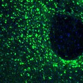 Anti-RCN2 antibody produced in rabbit Prestige Antibodies® Powered by Atlas Antibodies, affinity isolated antibody, buffered aqueous glycerol solution