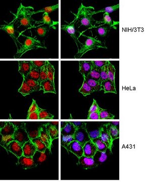 Anti-FOXH1 Antibody from rabbit, purified by affinity chromatography