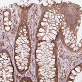 Anti-TECR antibody produced in rabbit Prestige Antibodies® Powered by Atlas Antibodies, affinity isolated antibody, buffered aqueous glycerol solution