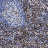 Anti-GIMAP4 antibody produced in rabbit Prestige Antibodies® Powered by Atlas Antibodies, affinity isolated antibody, buffered aqueous glycerol solution, Ab2