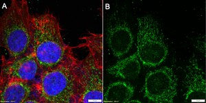 Anti-C1QBP Antibody, clone 3D2 ZooMAb® Rabbit Monoclonal recombinant, expressed in HEK 293 cells