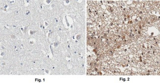 Anti-APP Antibody, CT, clone 2.F2.19B4, Ascites Free clone 2.F2.19B4, from mouse
