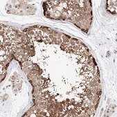Anti-TSNAX antibody produced in rabbit Prestige Antibodies® Powered by Atlas Antibodies, affinity isolated antibody, buffered aqueous glycerol solution, ab2