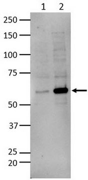 Anti-Dyskerin (Sheep) from sheep, purified by affinity chromatography ...